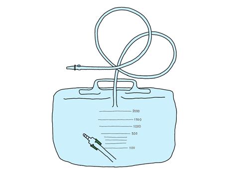 カテーテル留置について 【説明】